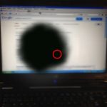 unnamed ¿Qué es la maculopatía miópica? | Diagnóstico y Tratamiento