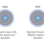Control de miopía con lentes oftálmicas asféricas